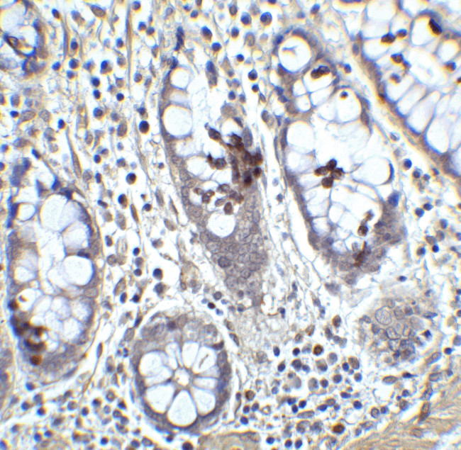 KLF4 Antibody in Immunohistochemistry (IHC)