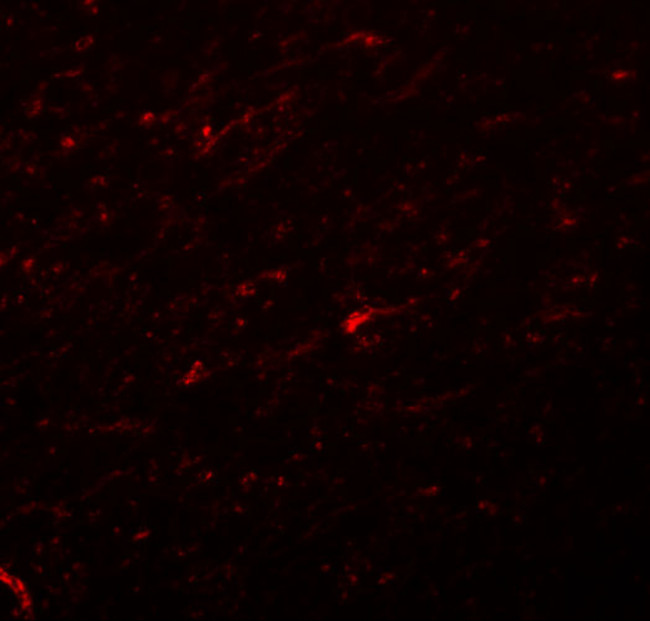 TCF3 Antibody in Immunohistochemistry (IHC)