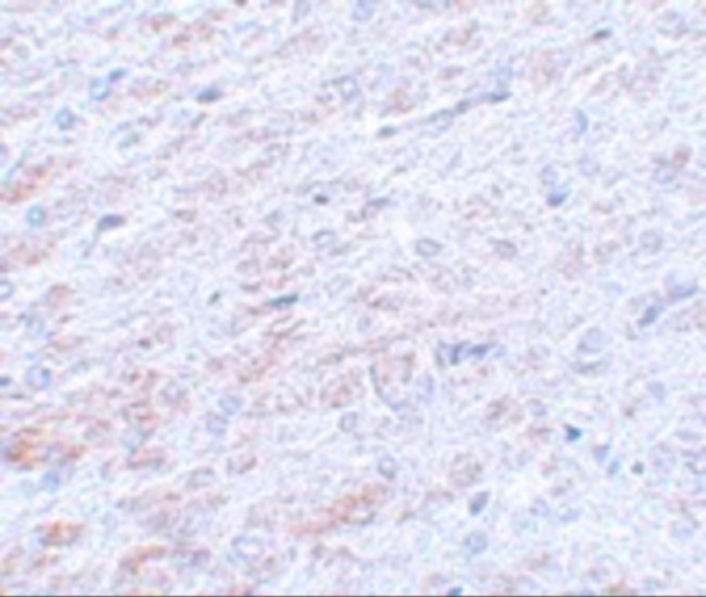 TCF3 Antibody in Immunohistochemistry (IHC)