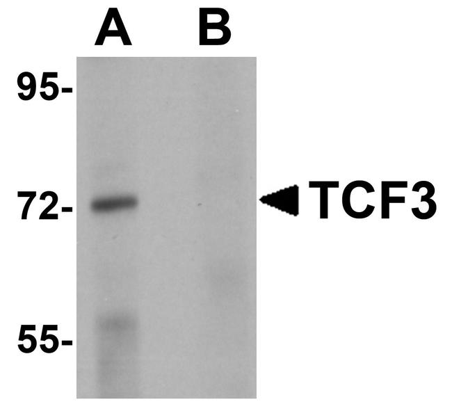 TCF3 Antibody in Western Blot (WB)