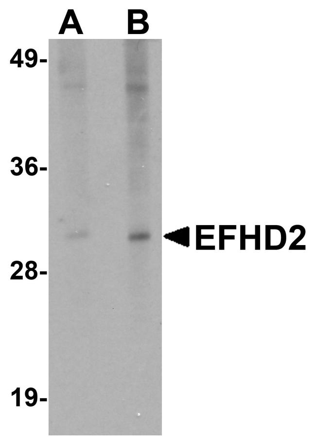 EFHD2 Polyclonal Antibody (PA5-20919)