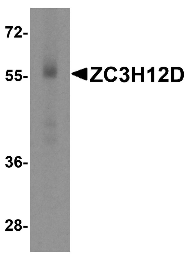 ZC3H12D Antibody in Western Blot (WB)
