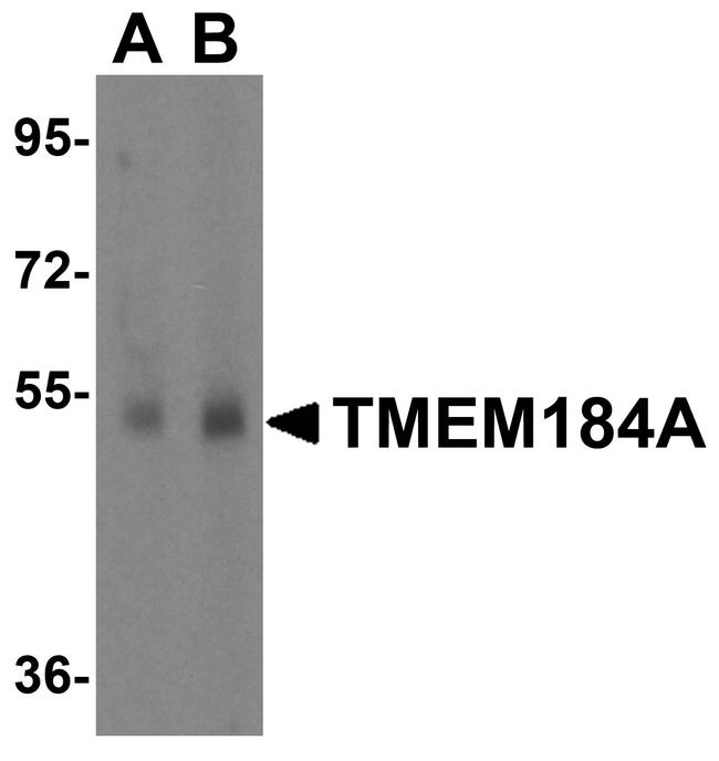 TMEM184A Antibody in Western Blot (WB)
