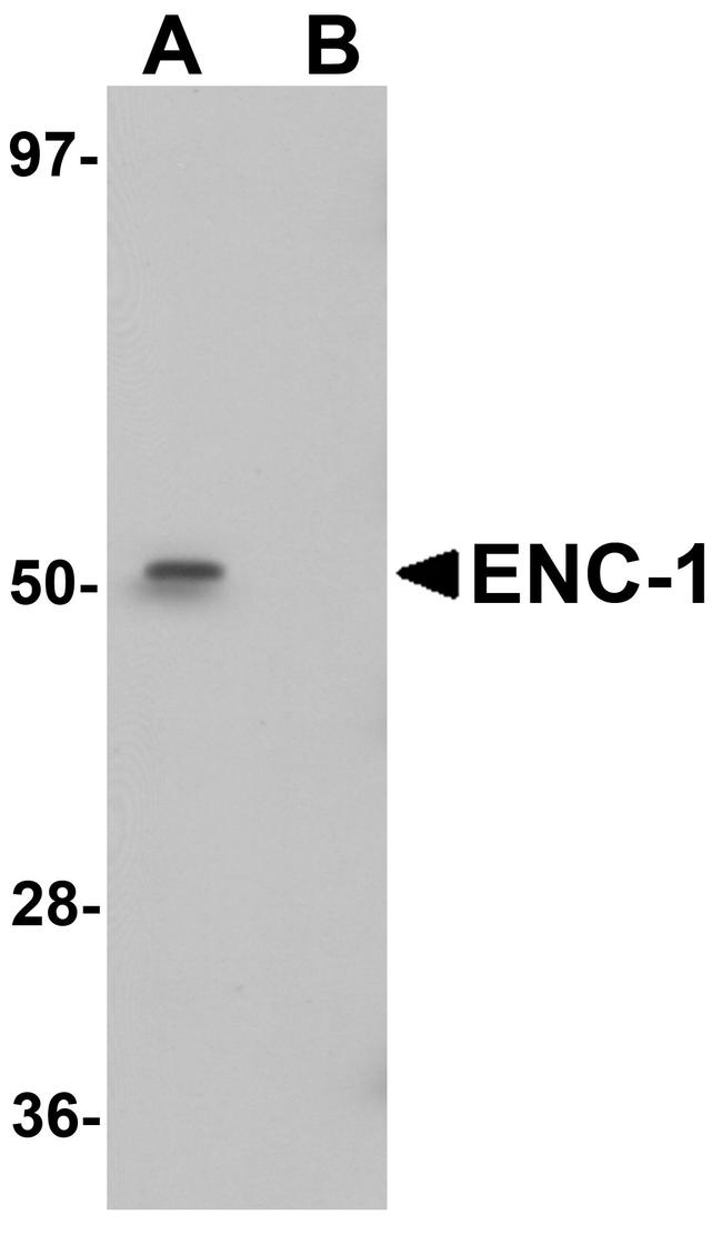 ENC1 Antibody in Western Blot (WB)