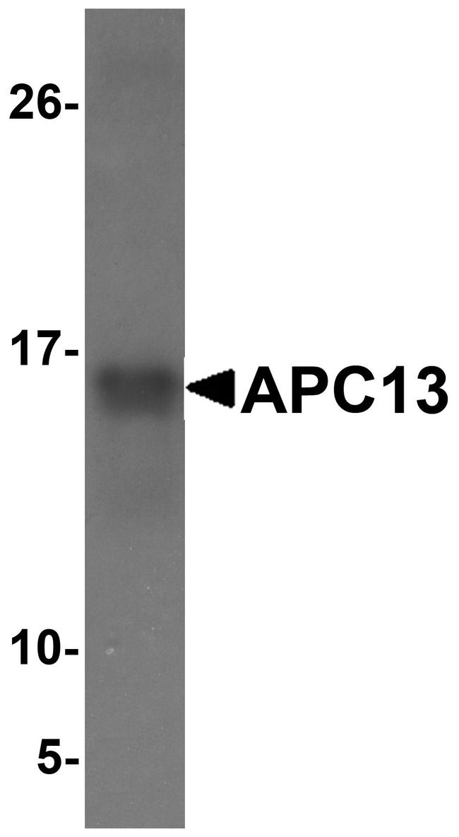 APC13 Antibody in Western Blot (WB)