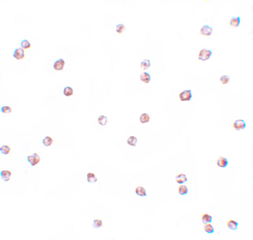 FOXO3A Antibody in Immunocytochemistry (ICC/IF)