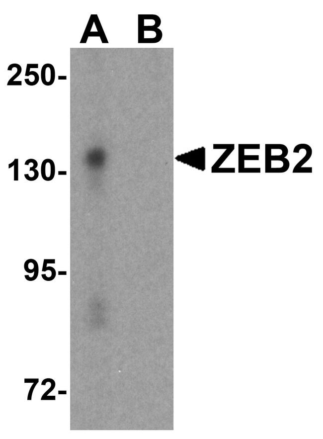 ZEB2 Antibody in Western Blot (WB)