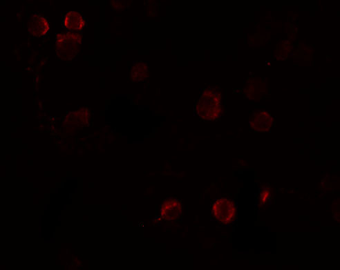 FREM1 Antibody in Immunocytochemistry (ICC/IF)