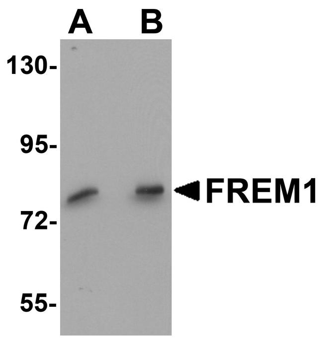 FREM1 Antibody in Western Blot (WB)