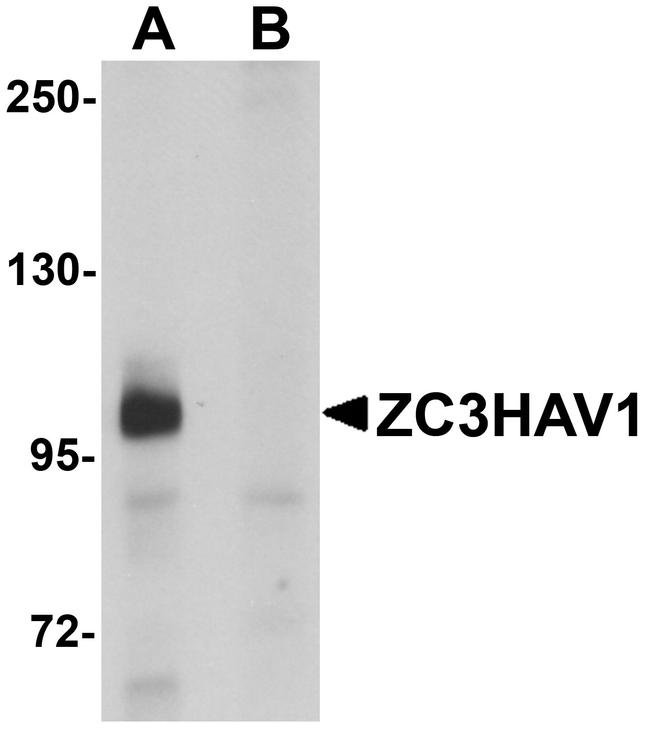 ZC3HAV1 Antibody in Western Blot (WB)