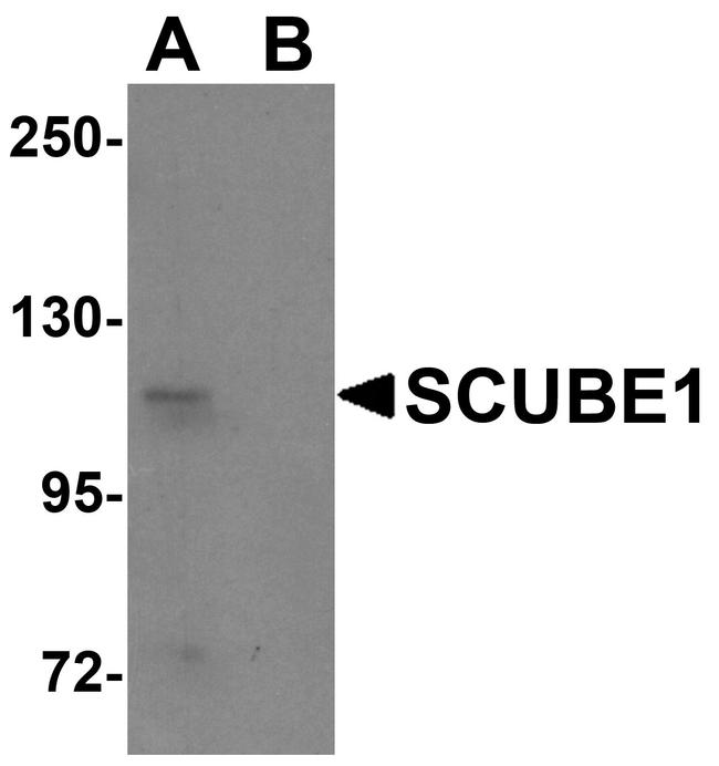 SCUBE1 Antibody in Western Blot (WB)