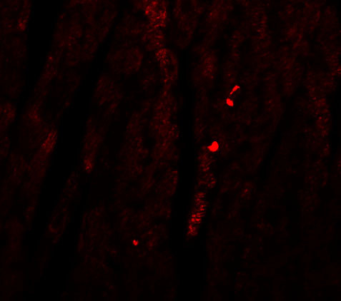 ATG13 Antibody in Immunohistochemistry (IHC)