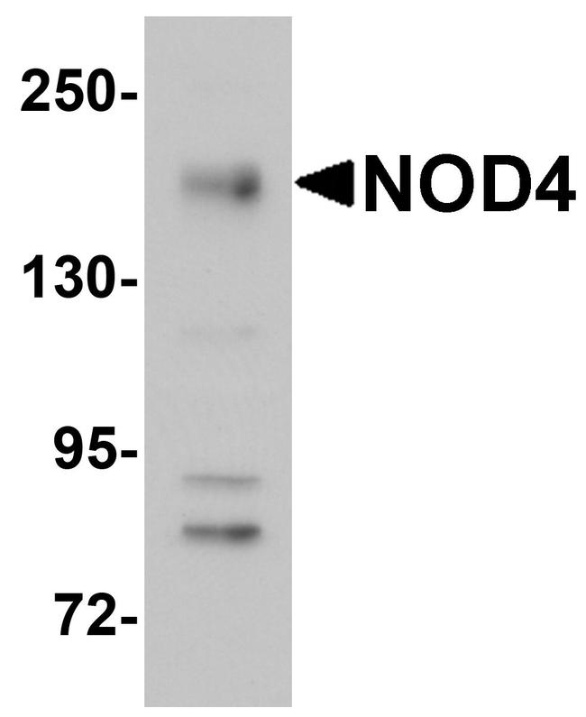 NOD4 Antibody in Western Blot (WB)