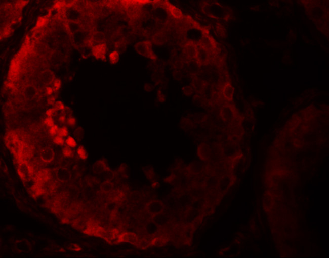 NALP9 Antibody in Immunohistochemistry (IHC)