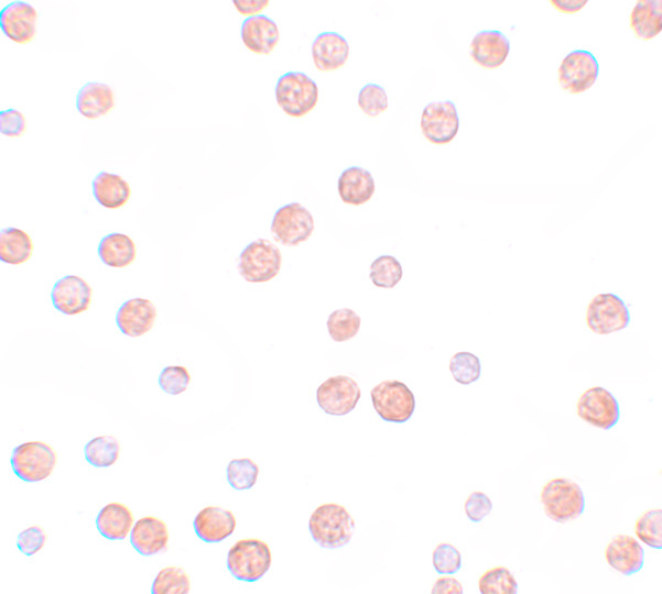 PAPPA2 Antibody in Immunocytochemistry (ICC/IF)