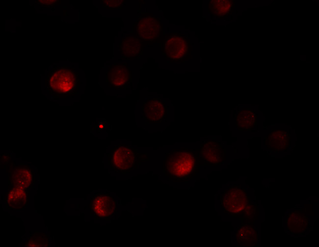 PAPPA2 Antibody in Immunocytochemistry (ICC/IF)