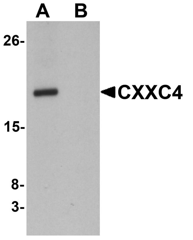 CXXC4 Antibody in Western Blot (WB)