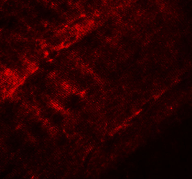 SYNPO2 Antibody in Immunohistochemistry (IHC)