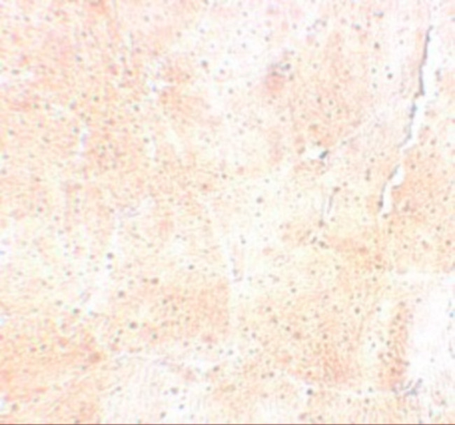 SYNPO2 Antibody in Immunohistochemistry (IHC)