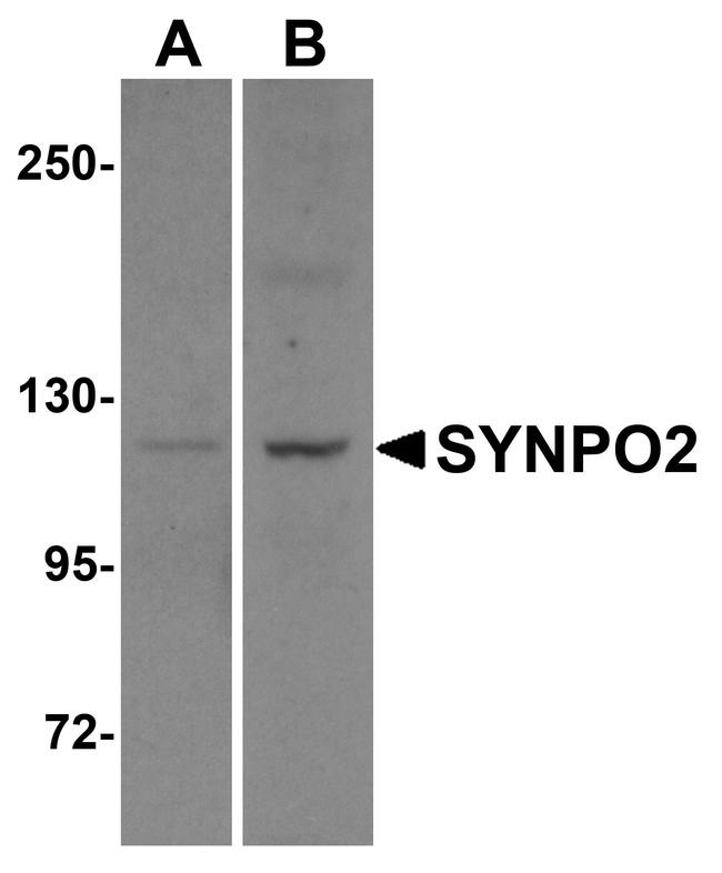 SYNPO2 Antibody in Western Blot (WB)