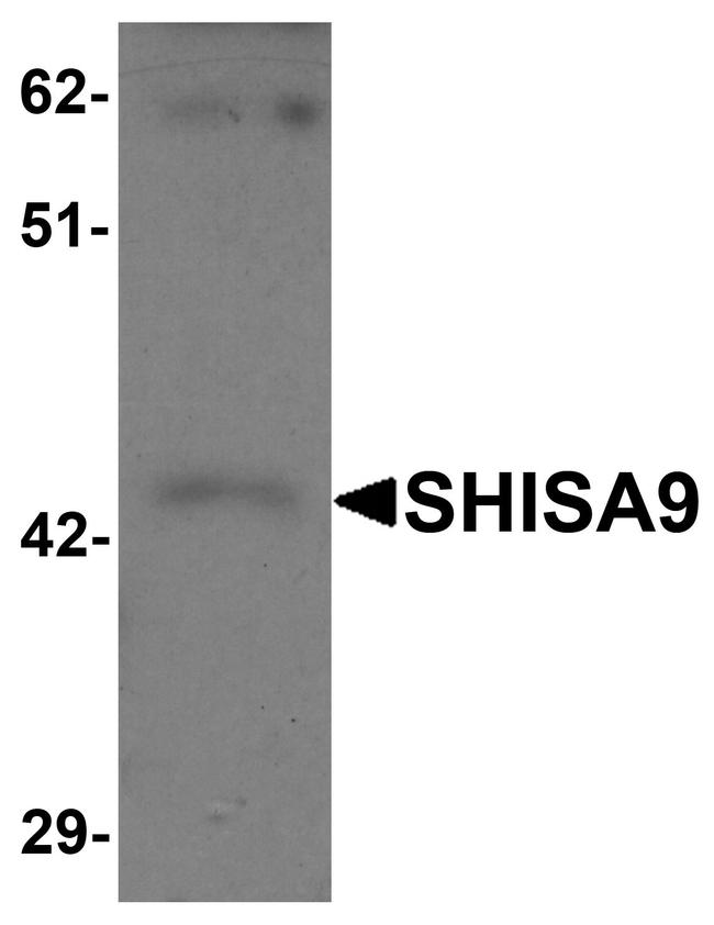 SHISA9 Antibody in Western Blot (WB)