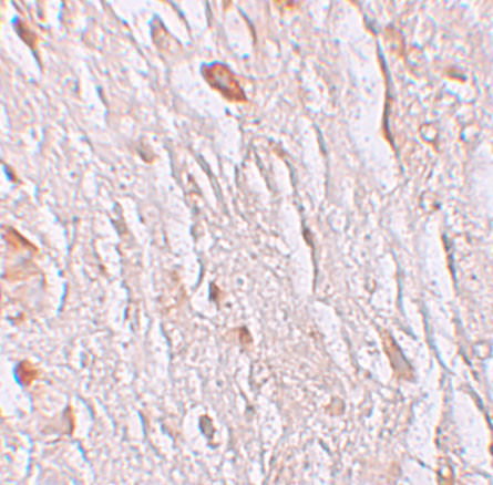 SLC39A7 Antibody in Immunohistochemistry (Paraffin) (IHC (P))