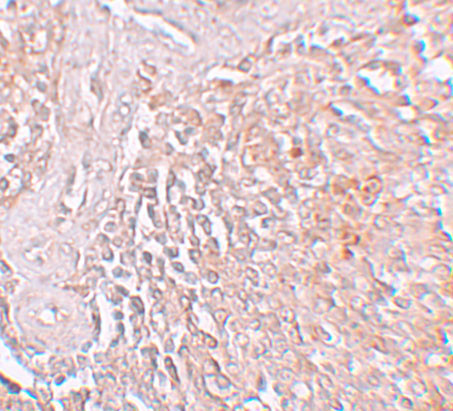 SLC39A8 Antibody in Immunohistochemistry (IHC)