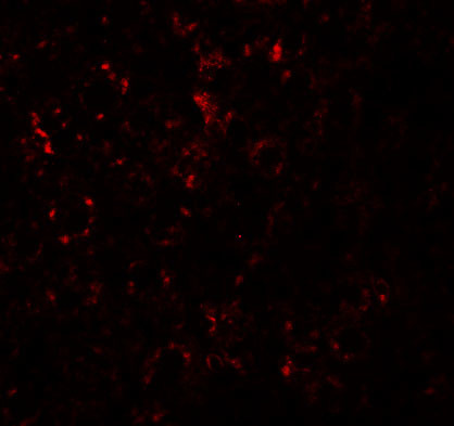 ZIP14 Antibody in Immunohistochemistry (IHC)