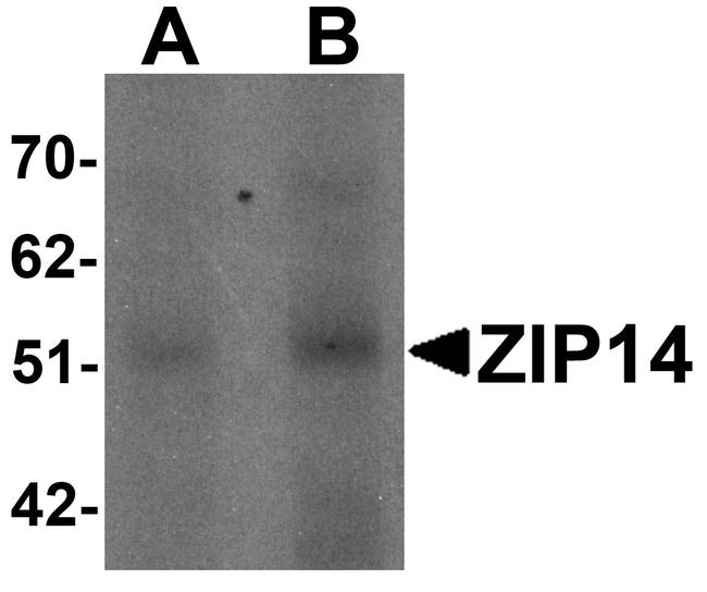 ZIP14 Antibody in Western Blot (WB)