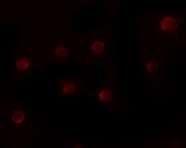 ZMYM2 Antibody in Immunocytochemistry (ICC/IF)