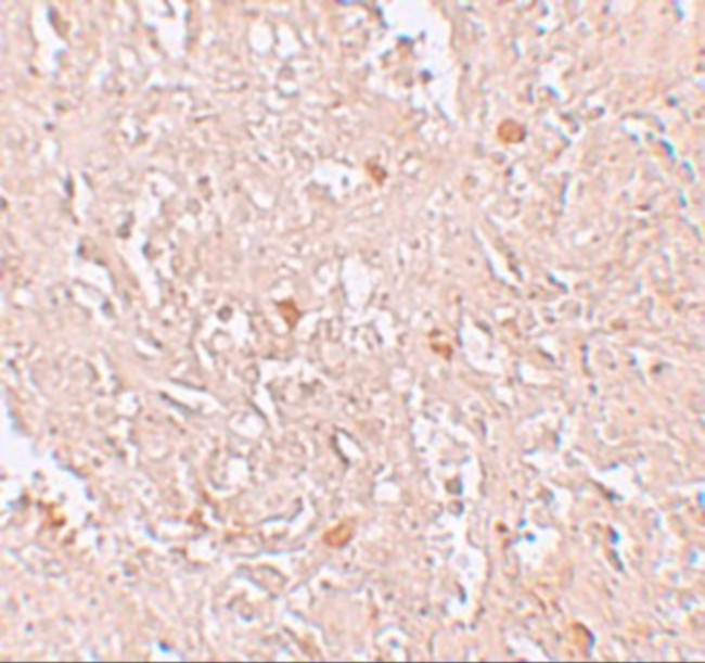 FBXL16 Antibody in Immunohistochemistry (IHC)