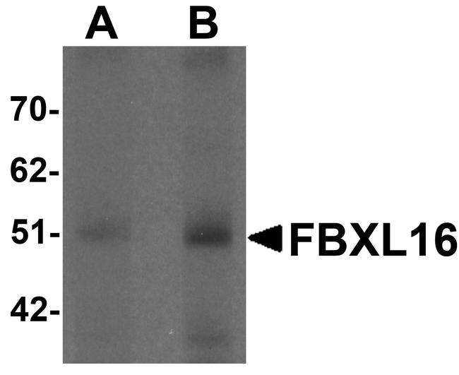 FBXL16 Antibody in Western Blot (WB)