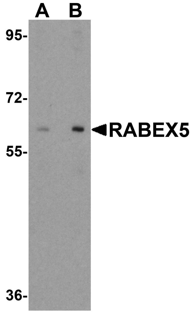 Rabex-5 Antibody in Western Blot (WB)