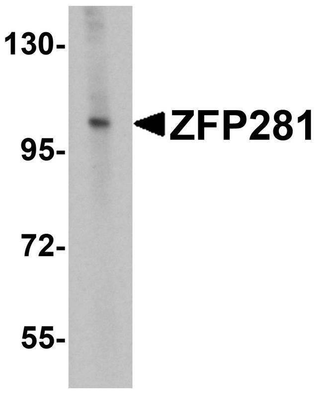 ZNF281 Antibody in Western Blot (WB)