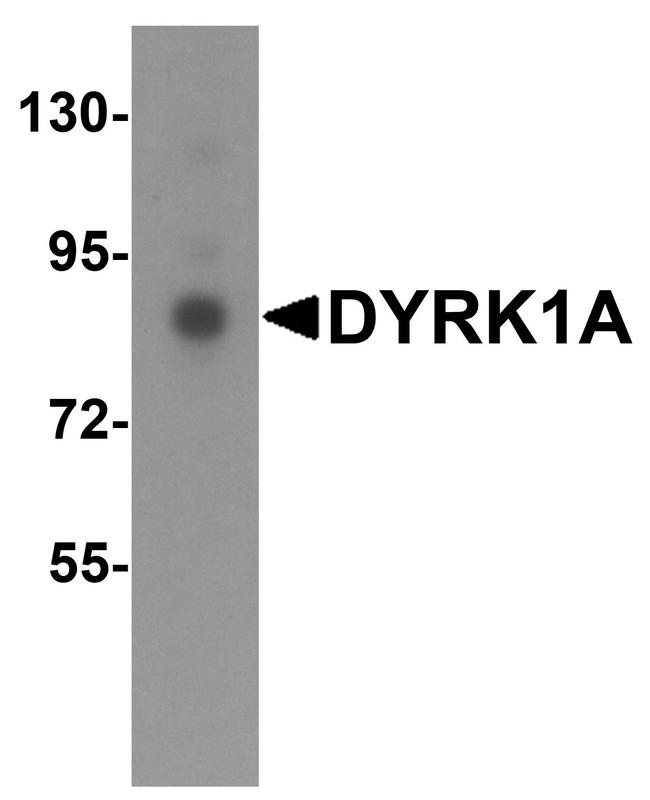 DYRK1A Antibody in Western Blot (WB)