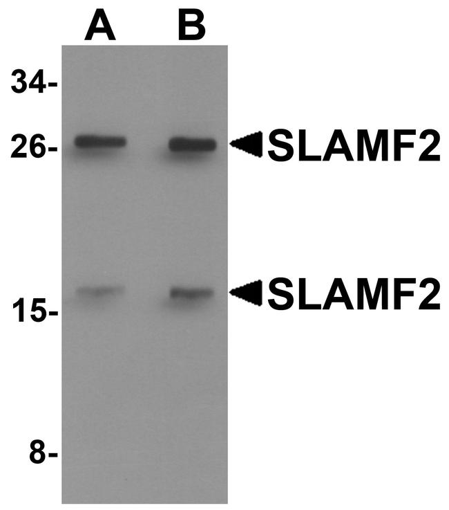 CD48 Antibody in Western Blot (WB)