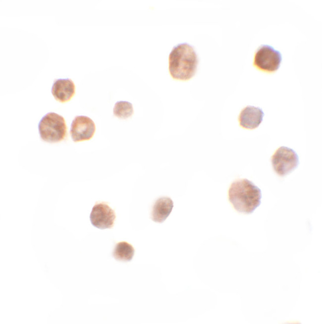 TRMT12 Antibody in Immunocytochemistry (ICC/IF)