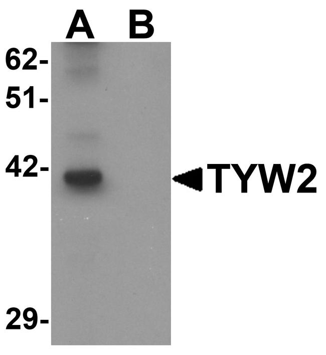 TRMT12 Antibody in Western Blot (WB)