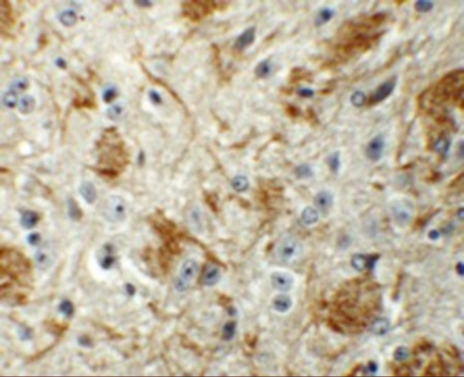 LCMT2 Antibody in Immunohistochemistry (IHC)