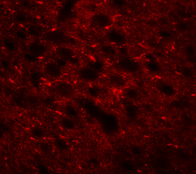 TMEM88 Antibody in Immunohistochemistry (IHC)