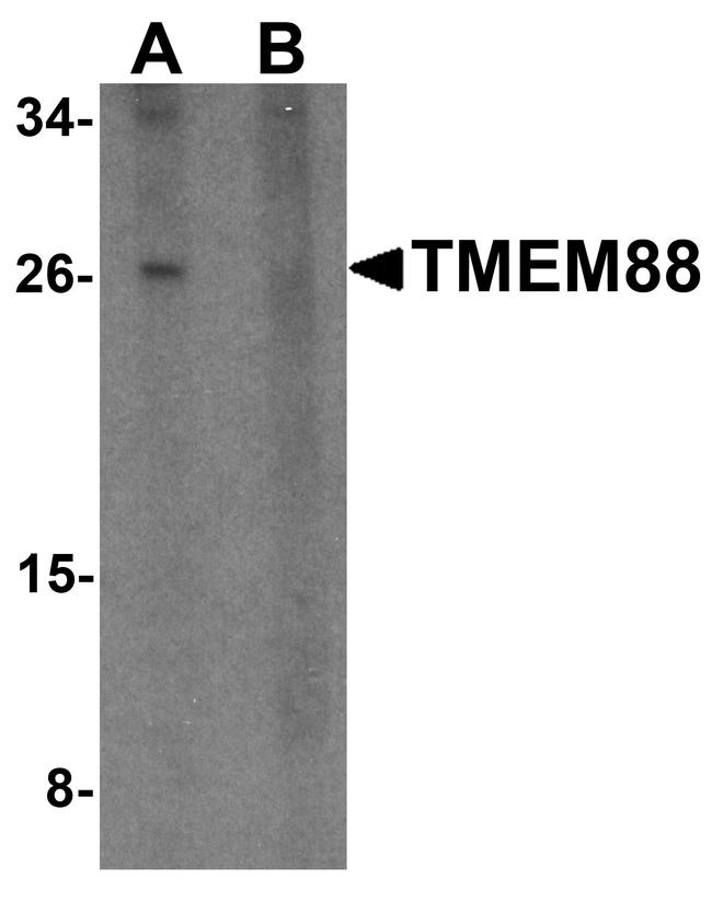 TMEM88 Antibody in Western Blot (WB)