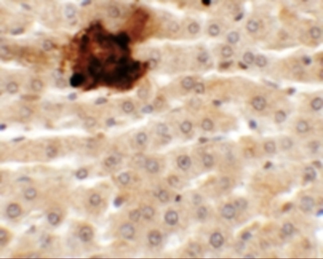 SYTL5 Antibody in Immunohistochemistry (IHC)