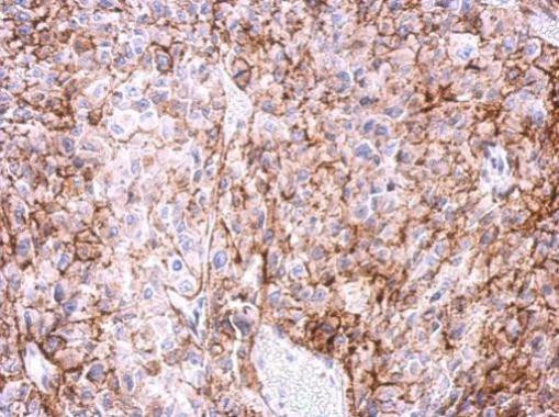 ADORA2A Antibody in Immunohistochemistry (Paraffin) (IHC (P))