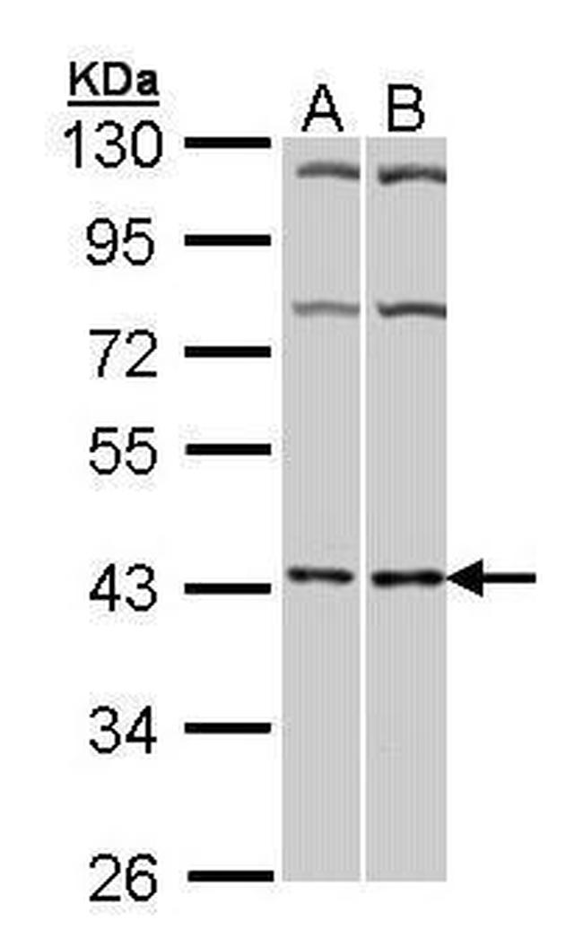 ADORA2A Antibody in Western Blot (WB)