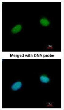 XRCC3 Antibody in Immunocytochemistry (ICC/IF)