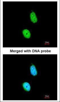 ERCC8 Antibody in Immunocytochemistry (ICC/IF)