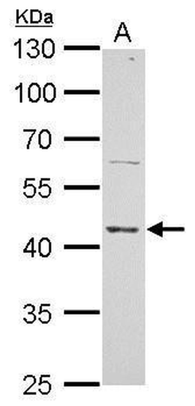 ERCC8 Antibody in Western Blot (WB)