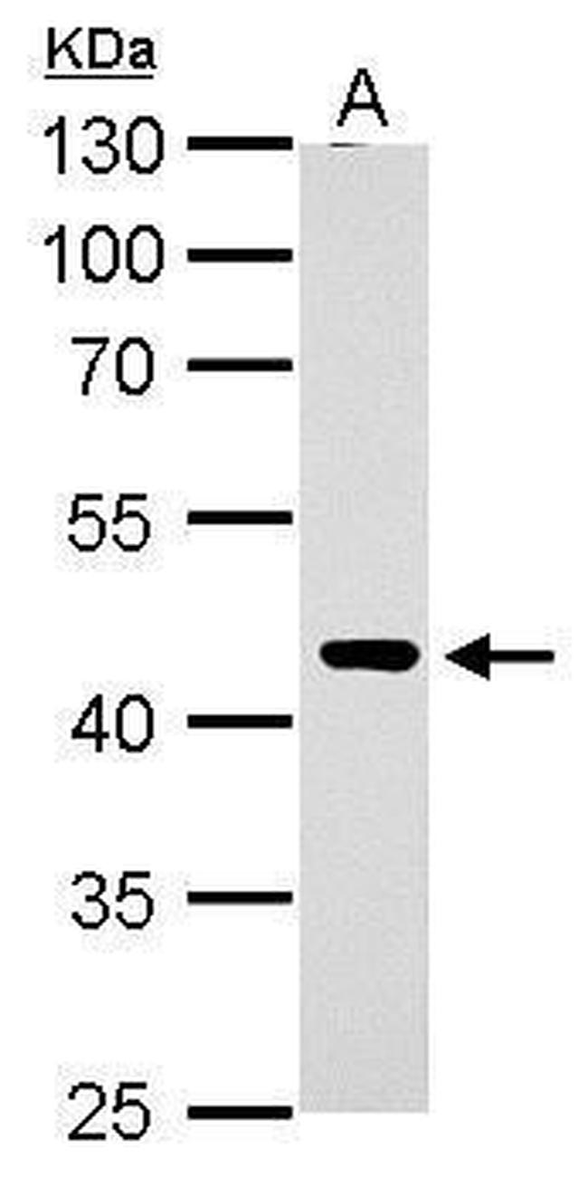 ERCC8 Antibody in Western Blot (WB)