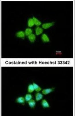 DUSP8 Antibody in Immunocytochemistry (ICC/IF)