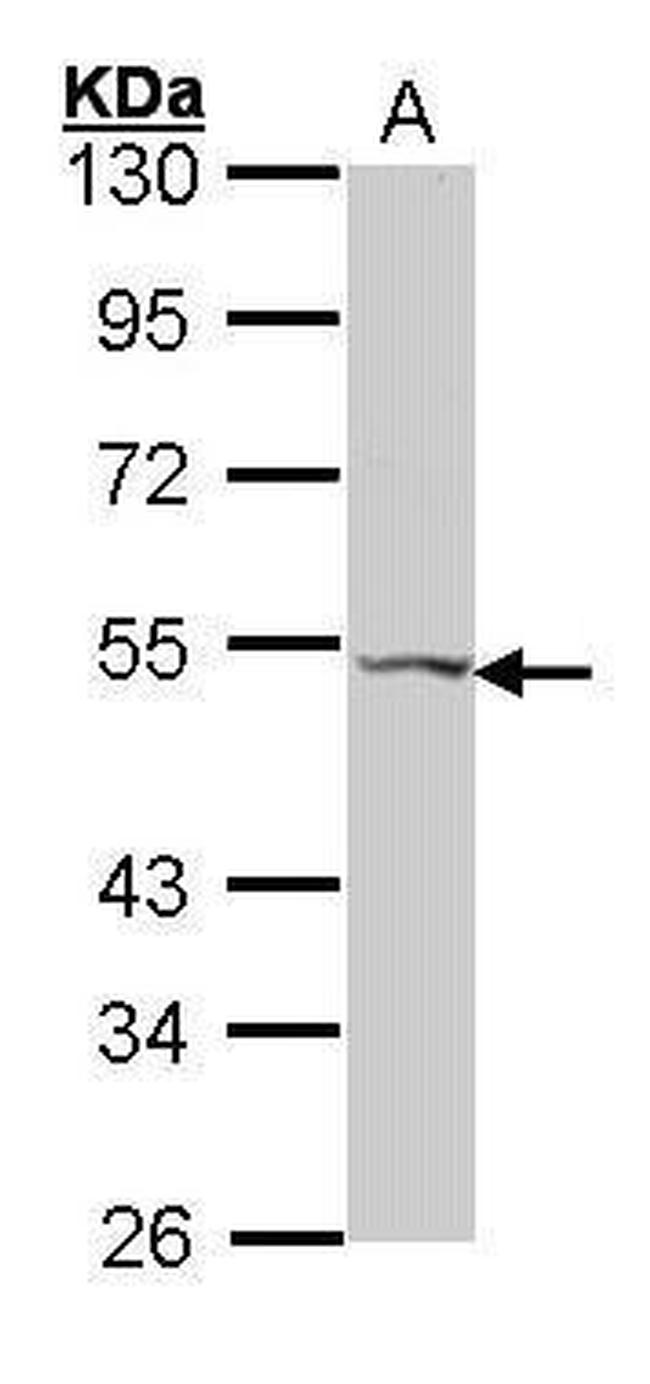 VPAC2 Antibody in Western Blot (WB)